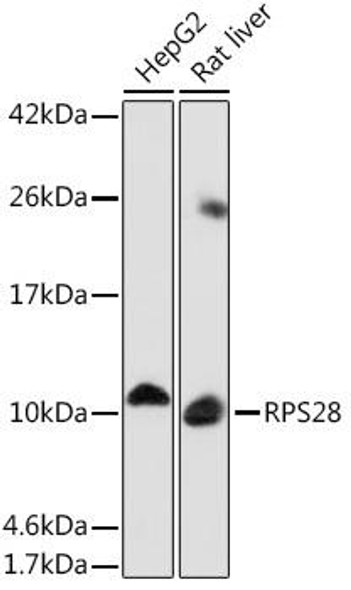 Cell Biology Antibodies 14 Anti-RPS28 Antibody CAB17937