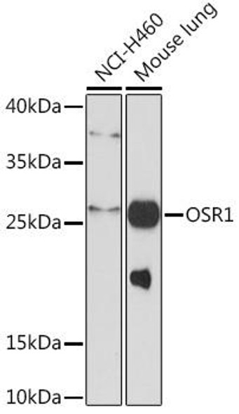 Cell Biology Antibodies 14 Anti-OSR1 Antibody CAB17939