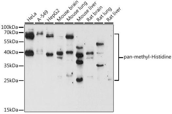 Cell Biology Antibodies 14 Anti-pan-methyl-Histidine Antibody CAB17948
