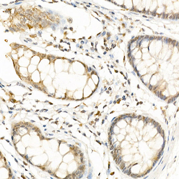 Immunohistochemistry of paraffin-embedded human colon using RGS2 Rabbit pAb at dilution of 1:100 (40x lens). Perform high pressure antigen retrieval with 10 mM citrate buffer pH 6. 0 before commencing with IHC staining protocol.
