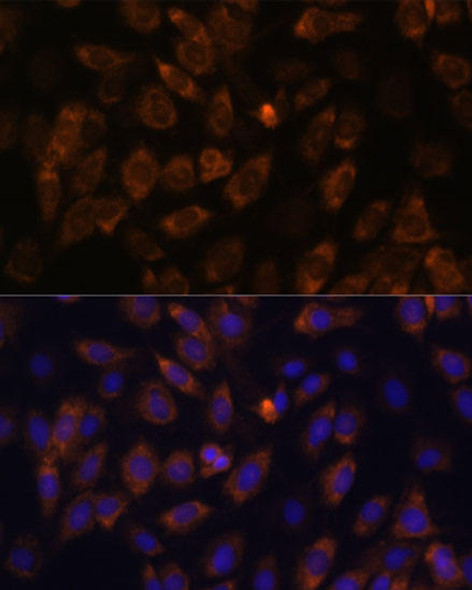 Cell Biology Antibodies 14 Anti-MT-ND4L Antibody CAB17971