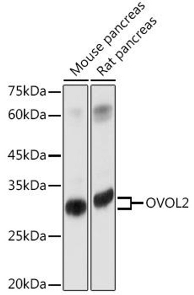 Cell Biology Antibodies 14 Anti-OVOL2 Antibody CAB17973