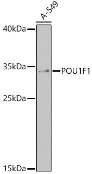 Cell Biology Antibodies 14 Anti-POU1F1 Antibody CAB17976