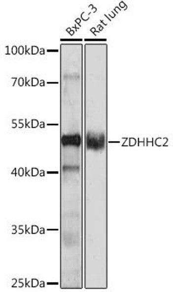 Cell Biology Antibodies 14 Anti-ZDHHC2 Antibody CAB17979