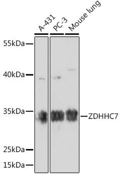 Cell Biology Antibodies 14 Anti-ZDHHC7 Antibody CAB17981