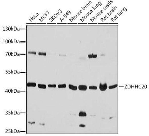 Cell Biology Antibodies 14 Anti-ZDHHC20 Antibody CAB17982
