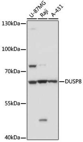 Cell Biology Antibodies 14 Anti-DUSP8 Antibody CAB17990