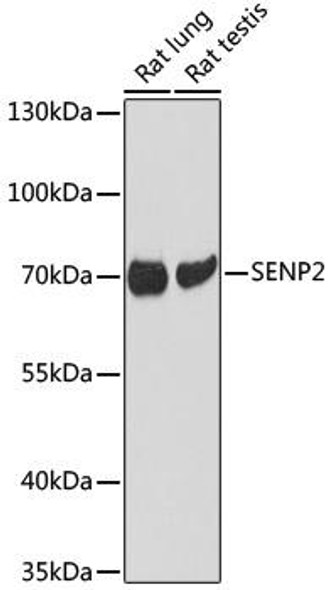 Cell Biology Antibodies 14 Anti-SENP2 Antibody CAB17994