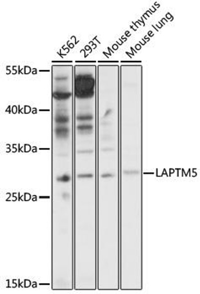 Cell Biology Antibodies 14 Anti-LAPTM5 Antibody CAB17995