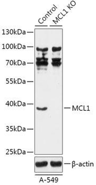KO Validated Antibodies 1 Anti-MCL1 Antibody CAB18001KO Validated