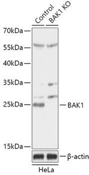 KO Validated Antibodies 1 Anti-Bak Antibody CAB18002KO Validated