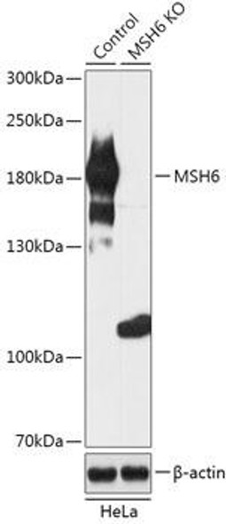 KO Validated Antibodies 1 Anti-MSH6 Antibody CAB18007KO Validated