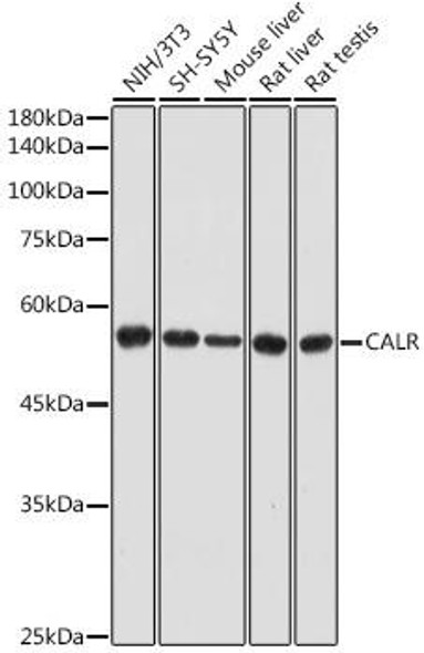 KO Validated Antibodies 1 Anti-CALR Antibody CAB18013KO Validated