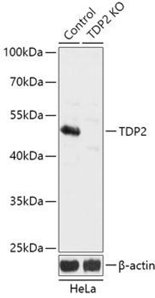 KO Validated Antibodies 1 Anti-TDP2 Antibody CAB18017KO Validated
