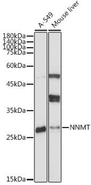 KO Validated Antibodies 1 Anti-NNMT Antibody CAB18033KO Validated