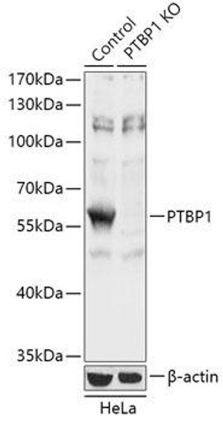 KO Validated Antibodies 1 Anti-PTBP1 Antibody CAB18052KO Validated