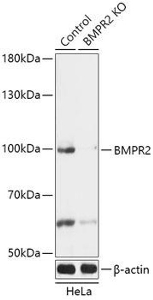 KO Validated Antibodies 1 Anti-BMPR2 Antibody CAB18079KO Validated