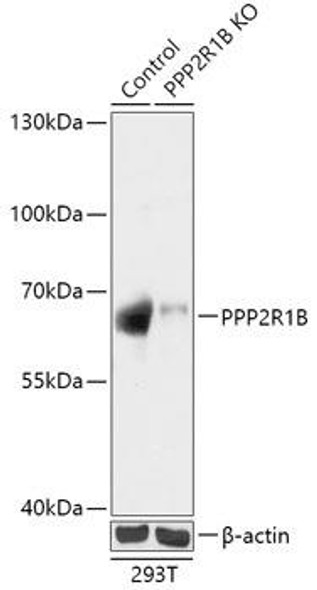 KO Validated Antibodies 2 Anti-PPP2R1B Antibody CAB18089KO Validated