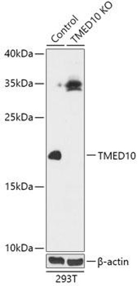 KO Validated Antibodies 2 Anti-TMED10 Antibody CAB18090KO Validated