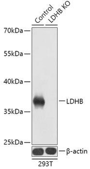 KO Validated Antibodies 2 Anti-LDHB Antibody CAB18096KO Validated