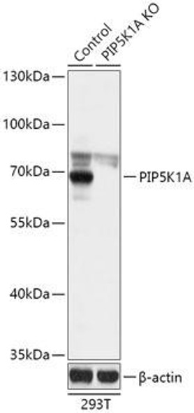 KO Validated Antibodies 2 Anti-PIP5K1A Antibody CAB18099KO Validated
