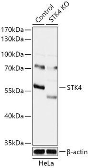 KO Validated Antibodies 2 Anti-STK4 Antibody CAB18100KO Validated