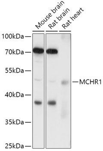 Cell Biology Antibodies 14 Anti-MCHR1 Antibody CAB18111