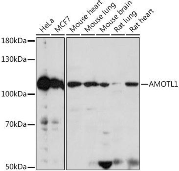 Cell Biology Antibodies 14 Anti-AMOTL1 Antibody CAB18112