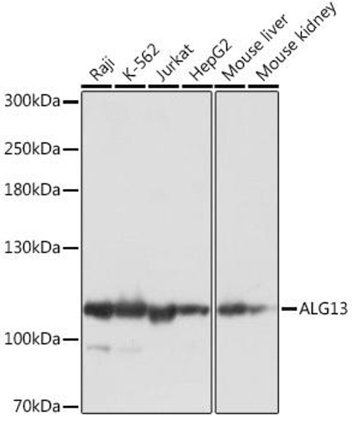 Cell Biology Antibodies 14 Anti-ALG13 Antibody CAB18115