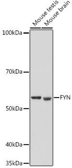 Immunology Antibodies 3 Anti-FYN Antibody CAB18127