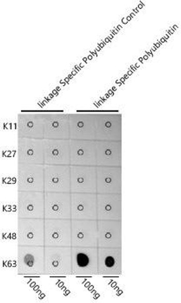 Cell Biology Antibodies 14 Anti-K63-linkage Specific Polyubiquitin Antibody CAB18164