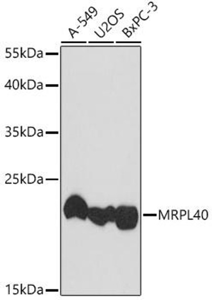 Cell Biology Antibodies 14 Anti-MRPL40 Antibody CAB18191