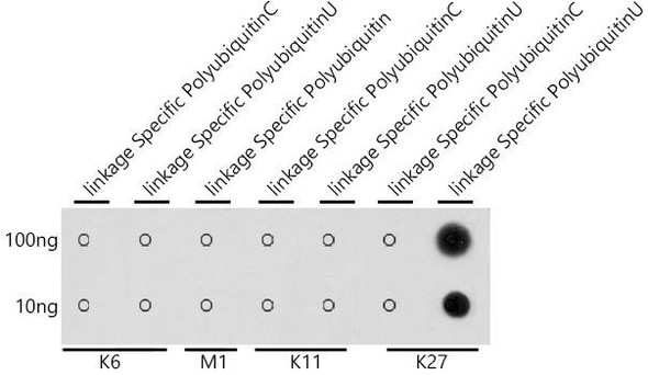 Cell Biology Antibodies 14 Anti-K29-linkage Specific Polyubiquitin Antibody CAB18198