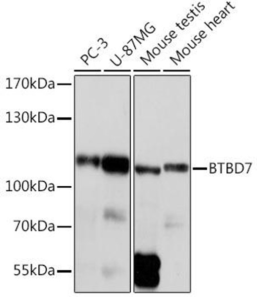 Cell Biology Antibodies 14 Anti-BTBD7 Antibody CAB18206