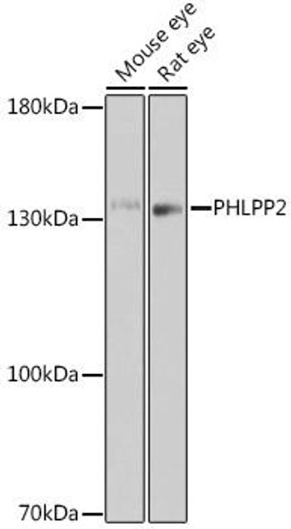 Cell Biology Antibodies 18 Anti-PHLPP2 Antibody CAB18218