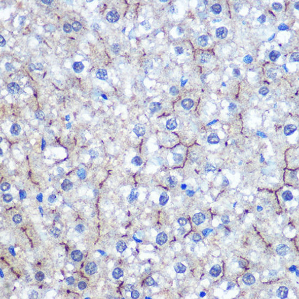 Cell Biology Antibodies 18 Anti-HILPDA Antibody CAB18221