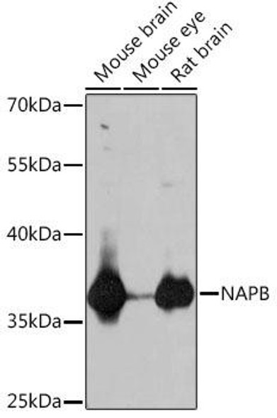 Cell Biology Antibodies 18 Anti-NAPB Antibody CAB18223