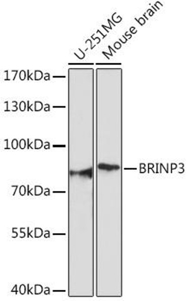 Cell Biology Antibodies 18 Anti-BRINP3 Antibody CAB18237