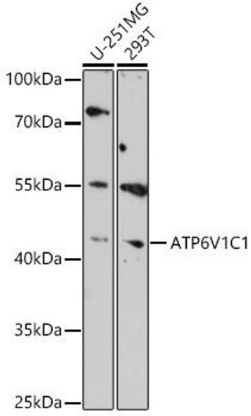 Cell Biology Antibodies 18 Anti-ATP6V1C1 Antibody CAB18253
