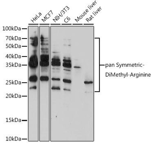 Cell Biology Antibodies 18 Anti-pan-Symmetric-Di-Methyl Arginine Antibody CAB18261