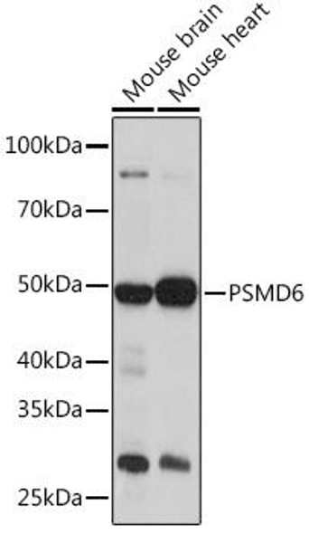 Cell Biology Antibodies 18 Anti-PSMD6 Antibody CAB18263