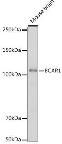Cell Biology Antibodies 18 Anti-BCAR1 Antibody CAB18270
