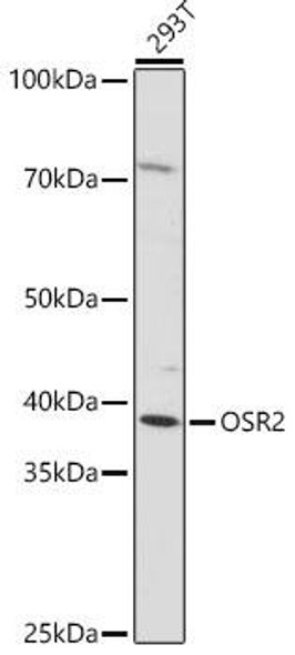 Cell Biology Antibodies 18 Anti-OSR2 Antibody CAB18271
