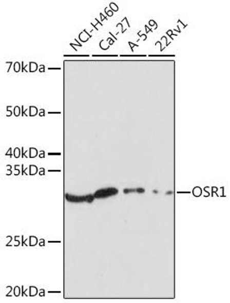 Cell Biology Antibodies 18 Anti-OSR1 Antibody CAB18272