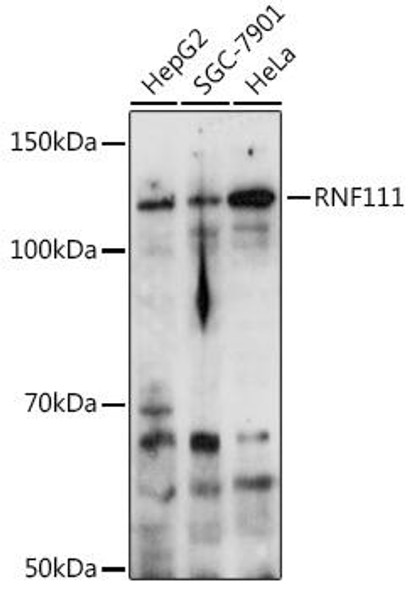 Cell Biology Antibodies 18 Anti-RNF111 Antibody CAB18277