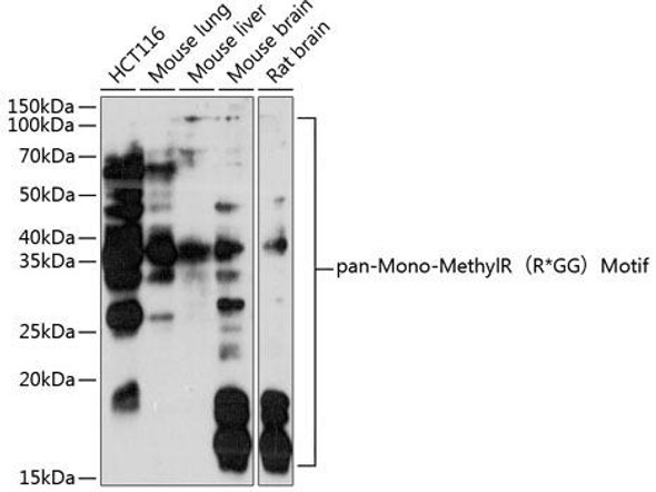 Cell Biology Antibodies 18 Anti-pan-Mono-Methyl R-R GG Motif Antibody CAB18297