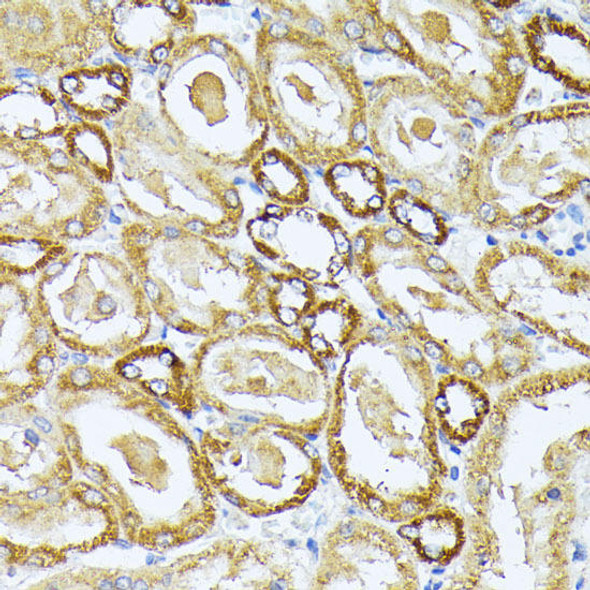 Cell Biology Antibodies 18 Anti-MT-CO3 Antibody CAB18318