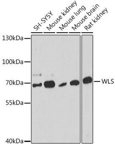 Cell Biology Antibodies 18 Anti-WLS Antibody CAB18328