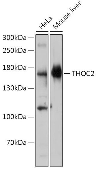 Cell Biology Antibodies 18 Anti-THOC2 Antibody CAB18332