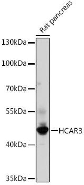 Cell Biology Antibodies 18 Anti-HCAR3 Antibody CAB18400